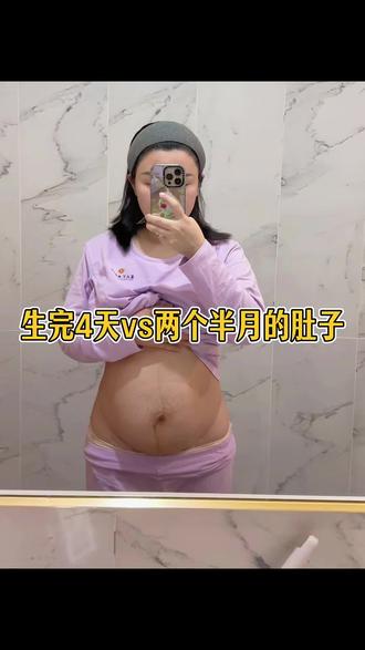 产后一个半月出门干活忙到现在两个半月~我只知道我很努力,我把自己养的很好,我很爱自己,我甚至忘了我刚生完一个孩子#剖腹产后 #剖腹产妈妈 #三娃宝妈 #好好爱自己 #产后工作@阿月月的朋友圈