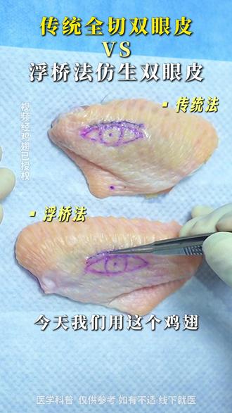传统全切法vs浮桥法双眼皮,你能看出来差别吗? #双眼皮手术 #成都双眼皮林威 #双眼皮 #双眼皮过程#浮桥法