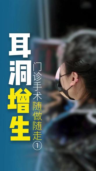 耳洞增生不要怕,门诊手术,随做随走!① #郑大一附院郭鹏飞 #郭鹏飞治疗疤痕疙瘩 #耳洞增生怎么消除 #耳骨增生怎么办 #耳洞增生疙瘩