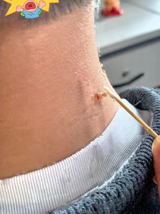 #脖子上的小啾啾 #变美就是这么简单