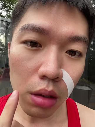 #法令纹贴 #法令纹 #鱼尾纹 #川字纹 #抬头纹