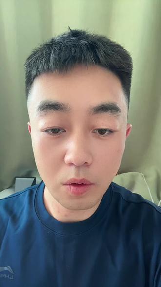 鼓气漏气 #面瘫 #面瘫患者 #面瘫后遗症 #鼓气漏气 #口轮匝肌