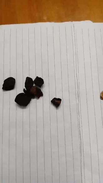 第九十二集,来自笔花医镜#中医 #中医养生