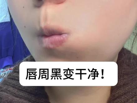两步让唇周黑变干净#唇周黑 #唇周黑怎么办 #去唇周黑 #变美 #护肤