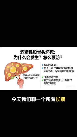 《酒精性股骨头坏死:为什么会发生?怎么预防?》#白酒#酒类小知识