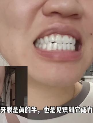 有时候和美女的差别就是这一口牙!你就涂吧!一涂一个不吱声#强烈推荐 #内容过于真实 #万万没想到 #牙膜 #社交恐惧
