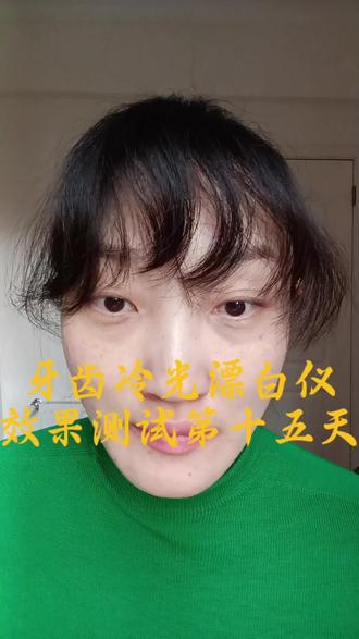 牙齿冷光漂白仪效果测试十五天#牙齿美白 #种草#真实还原 #避雷 #日用百货