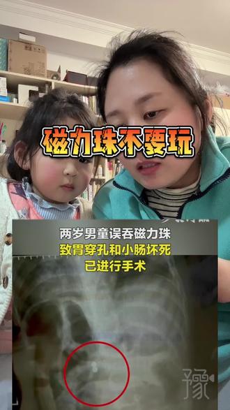 千万千万不要小看熊孩子的好奇心 谨慎给小朋友玩磁力珠#儿童安全 #亲子教育 #家长必读 #母女日常 #正确的引导孩子陪伴孩子