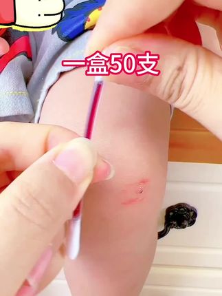 孩子平时跑跑跳跳的难免会受伤!提前为孩子备上#碘伏棉签 有备无患!#大人小孩都可以用   #好物推荐🔥 #实用好物 #母婴好物