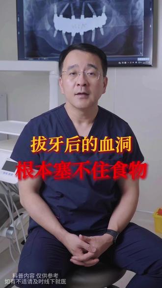 拔牙后的血洞,根本塞不住食物 #拔牙 #拔牙后的我 #医学科普 #龋齿 #北大口腔李率医生