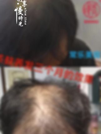 茶麸原浆洗发乳