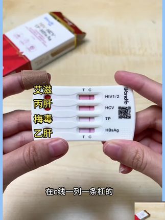 谈恋爱个发生关系前一定要测艾滋!15分钟出结果,准确率高达99.99%#hiv病毒 #艾滋病检测 #艾滋病阻断