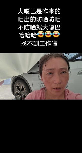 晒出大嘎巴怎么办呀#@#