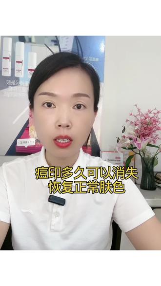 痘印多久恢复正常肤色#痘印