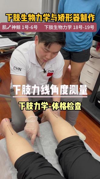 下肢力线角度测量 #运动 #康复训练 #下肢力线 #长短腿 #扁平足