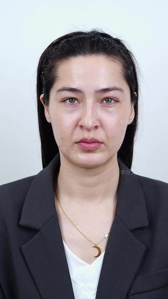 千万不要等到老了之后才来做#时光绷带 #李方文 #面部提升紧致抗衰