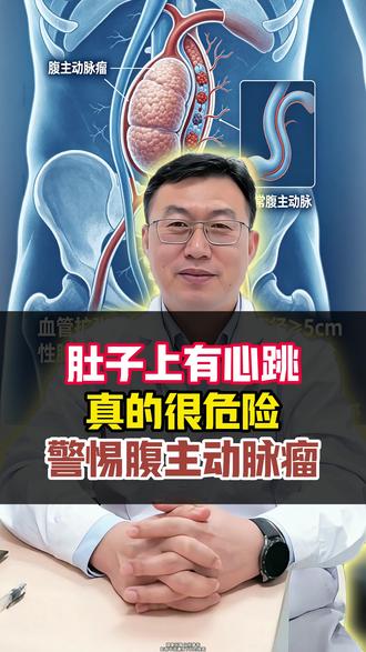 肚子上有“心跳”,警惕腹主动脉瘤 #腹主动脉瘤 #腹主动脉瘤手术 #腹主动脉瘤破裂 #健康科普 #冯海医生