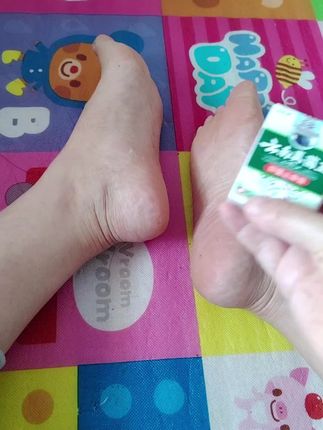 #足部护理 #可爱的小脚丫 #真菌王