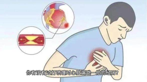 打喷嚏时,心脏会停跳一瞬间?