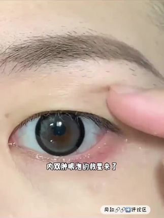 内双肿眼泡的,你的强来啦!#双眼皮贴 #内双 #肿眼泡 #双眼皮贴教程 #双眼皮吊顶