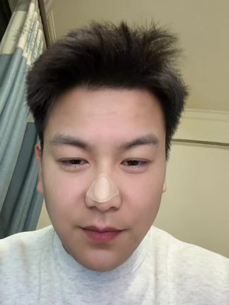 苍耳子鼻舒贴太好用啦#苍耳子鼻舒贴