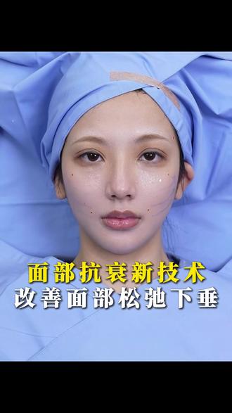 2026流行的变美方式,这三种提升不要做! #面部提升 #抗衰老 #变美变年轻 #女人爱美不分年龄 #精致女人