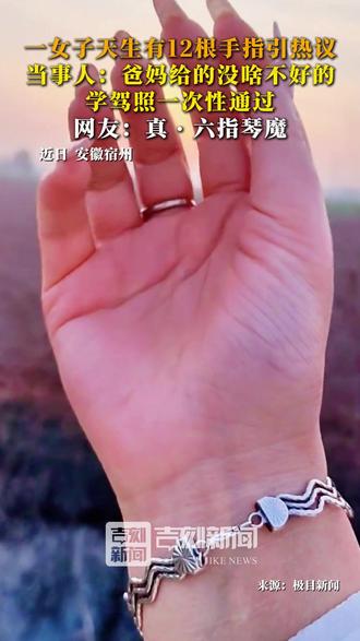 近日#安徽宿州 一女子天生有12根手指引热议,当事人:爸妈给的没啥不好的,学驾照一次性通过,网友:真·六指琴魔。#六指 #遗传 #乐观