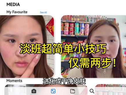 淡班超简单小技巧,仅需两步!大家理性参考噢~#雀斑#黄褐斑#晒斑#护肤#真实生活分享计划