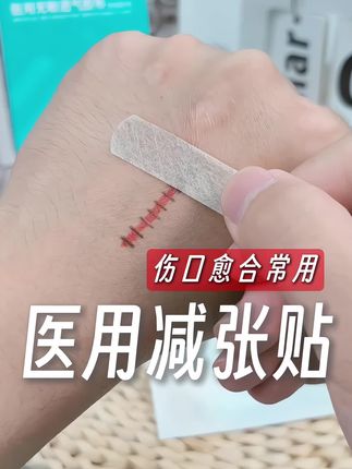 #疤痕 #疤痕增生 #疤痕体质 #减张贴 #疤痕疙瘩
