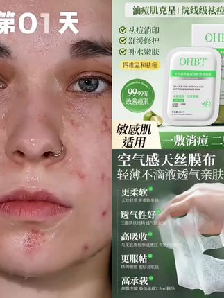 水杨酸祛痘面膜淡化痘印舒缓去闭口粉刺全脸痘补水保湿修护敏感肌#面膜 #保湿面膜 #面膜面膜敷起来