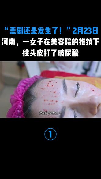 “悲剧还是发生了!”2月23日,河南,一女子在美容院的推销下,往头皮打了玻尿酸