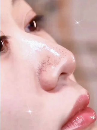 # 自用好物推荐青春期的孩子特别容易长黑头闭口,千万不能用手抠,快来试试袋鼠妈妈专为青少年设计的#黑头贴 真心不错,麻麻们赶紧薅#袋鼠妈妈  #去黑头 #学生党