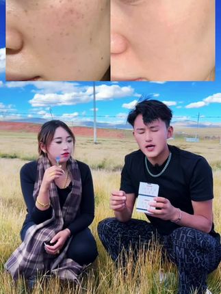 用期间做好补水和防晒#电商创业#好物推荐#好东西大家一起分享