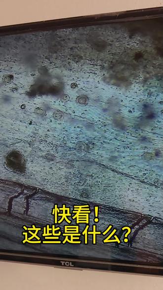 结论:定期杀虫非常重要!
#观赏鱼 #兰寿 #泰狮 #金鱼 #寄生虫