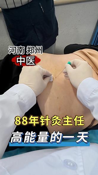 88年针灸主任高能量的一天 #刘亚光预约 #vlog十亿流量扶持计划 #vlog日常