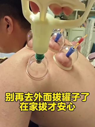 真后悔买晚了!!在家也能享受专业#拔罐 啦!!操作简单方便,哪里不舒服就拔哪里,放松肩颈 后背也舒服多了,需要的放心整!!#真空拔罐器 #肩颈疏通 #全身放松 #拔罐器推荐