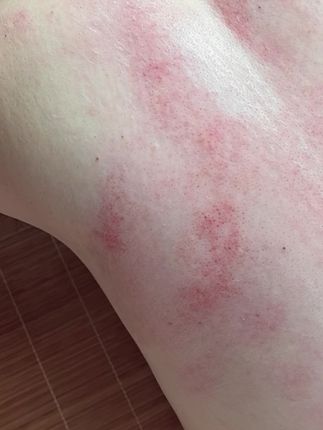疏通背部经络#调理身体 #健康生活 #预防大于冶疗 #健康养生