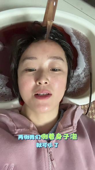 继续泡头 #银屑病 #银屑病自愈#莫离银屑病 #牛皮癣 #银屑病自愈