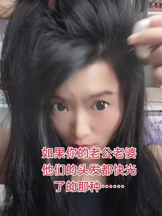 如果你的老公老婆的头发掉的差不多了,你都可以来找我,不妨给你推荐试一试,本人自用分享,不自用不分享#养发护发