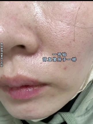 原来素颜掐出水是这种感觉!我一定要用到它停产为止!#护肤 #好皮肤养出来 #国货 #黑头 #控油 #祛痘 #植祛洗面奶