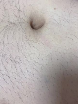 #看我的皮好看吗?