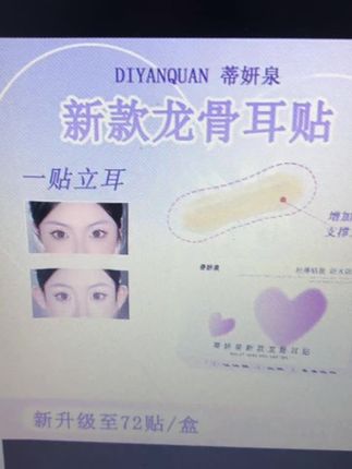 蒂妍泉龙骨耳贴立耳贴面耳招风耳隐形支撑大小脸显小定型女