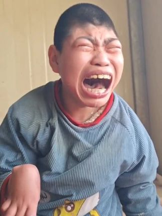 让大宝受尽痛的折磨是妈妈的不是#生活不会辜负每一个努力的人