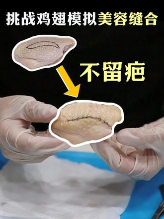 挑战用鸡翅模拟双眼皮美容缝合,不留疤#双眼皮 #双眼皮手术 #眼整形 #医美 #整形