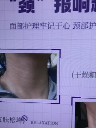 #面部护理