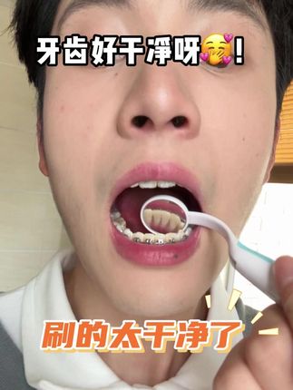 钢牙女孩牙套塞牙再也不怕了#皓齿舒 #牙缝刷 #钢牙妹 #牙套 #口腔健康