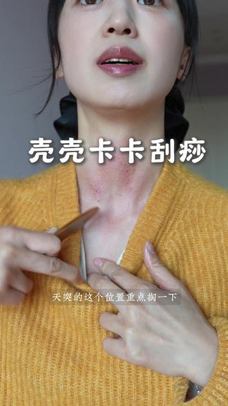 多学一个技能吧#甲流 #流感 #刮痧 #咳嗽