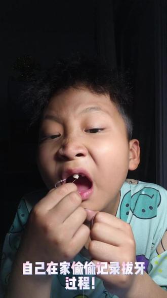 沉浸式拔乳牙!一根绳子!一拔一个不吱声 #人间观察计划 #创作灵感#亲子 #拔牙 @抖音创作小助手 @DOU+小助手