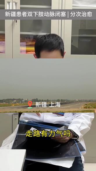 新疆患者从“走不动”到“走回去”的血管开通之路! 做科普,惠民生❤ 上海九院血管外科主任医师|从手术台到科普,帮你守护血管健康// 分享下肢动脉硬化闭塞症,糖尿病足,静脉血栓/后遗症,主动脉瘤/夹层等血管外科疾病的医学科普知识// 感谢你的关注/点赞/评论/收藏/转发
#青年创作者成长计划#医学科普 #血管外科殷敏毅 #动脉闭塞 #新疆