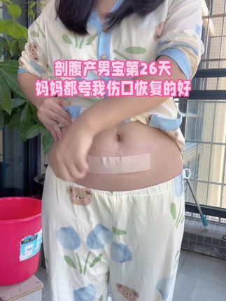剖腹产后,🧑⚕️叮嘱要注意清洁,7天后就可以洗澡了,但是避免伤口感染最好贴上防水贴,我一直到现在都还在用,保护的很好,剖腹产后做好防水很重要‼️#产后恢复 #待产包 #待产包必备